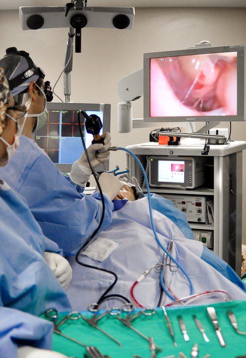 Endoscopic Nose Surgery at Capstone Clinic